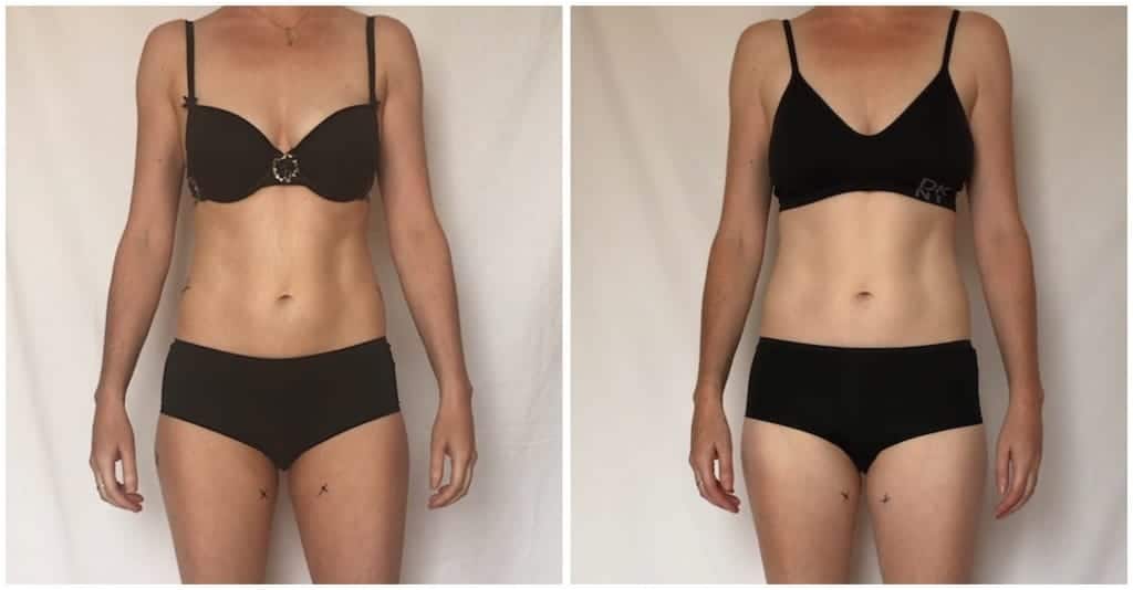 Close up comparison photos of my tummy and waist at the start before treatments and 9 weeks after a total of 23 treatments.