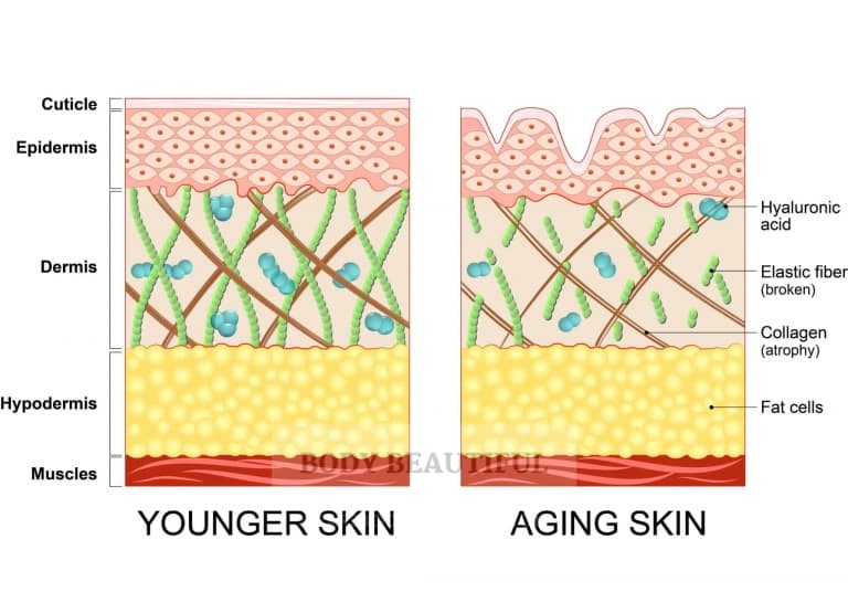 Cross section illustration of both younger skin and aging skin. Younger skin is smooth on the surface, organised in the epidermis, and packed with Hyaluronic Acid, collagen and elastin on the dermis. Aging skin is wrinkled at the surface, disordered in the epidermis, with less Hyaluronis Acid, broken elastin and weakened collagen fibres in the dermis.