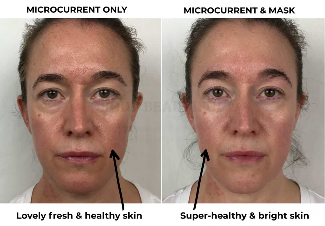 My CurrentBody skin Light therapy mask review before and after 4-weeks of using the CurrentBody Skin LED mask along with home microcurrent (Nuface). I went from lovely freshand healthy skin, to super healthy and bright skin. LOVE.