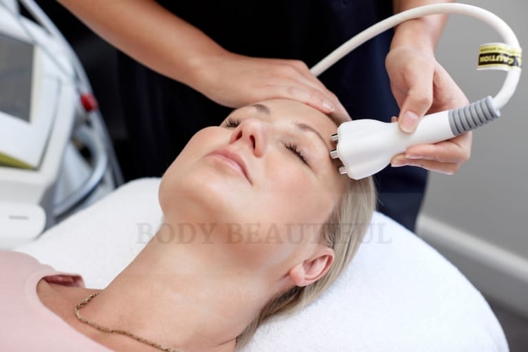 Bipolar Radio Frequency applied to the face to tighten skin during a professional Radio Frequency skin tightening.