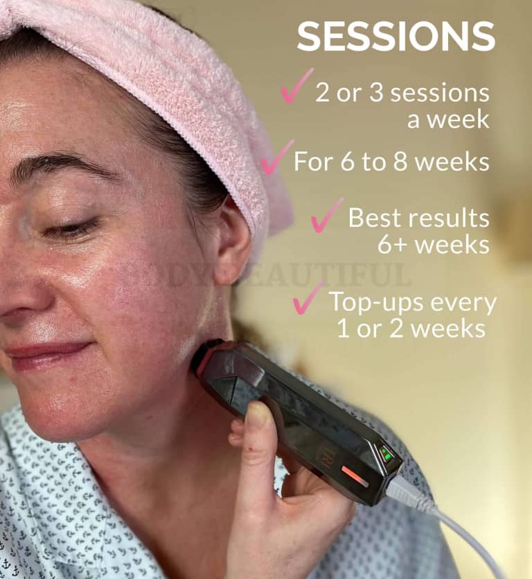 The Tripollar Stop VX is my favourite at-home RF device. you do 2 or 3 sessions per week, for 6 to 8 weeks. You'll see best results at 6+ weeks, and I saw further improvement at around 12 weeks. Then do top-ups every 1 or 2 weeks to maintain your results.