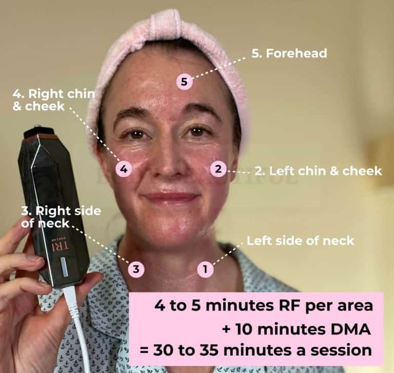treat each areas for 4 to 5 mins. There are 5 areas labeled on my face & neck: Left side of neck
Left chin and cheek
Right side of neck
Right chin and cheek
Forehead