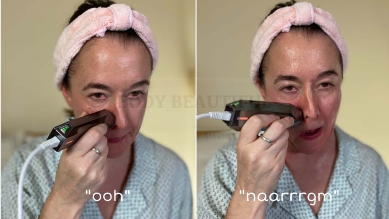 The larger electrodes on the STOP VX feel good around the corners of your nose too!