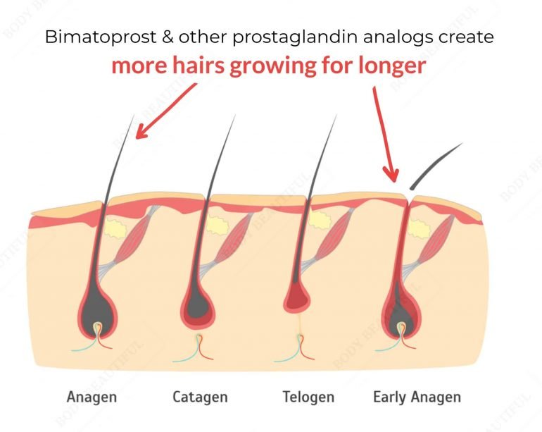 Diagram showing the hair growth cycle with a large hair follicles in Anagen growth, a grown catagen hair detaching from the bulb, a telegon hair no longer growing and retracting out the follicle, and an early anagen hair growing in the hair follicle bulb area again.
