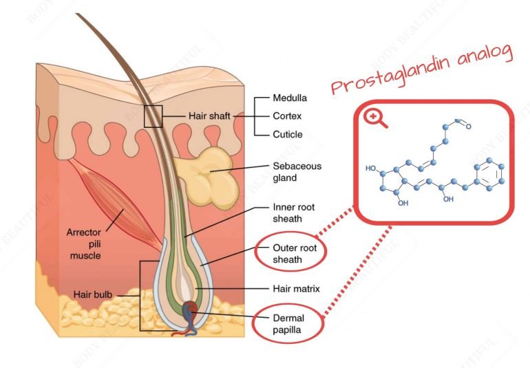Prostaglandin analogs affecting hair growth bind to receptors in your hair follicle primarily the dermal papilla and outer root sheath.
