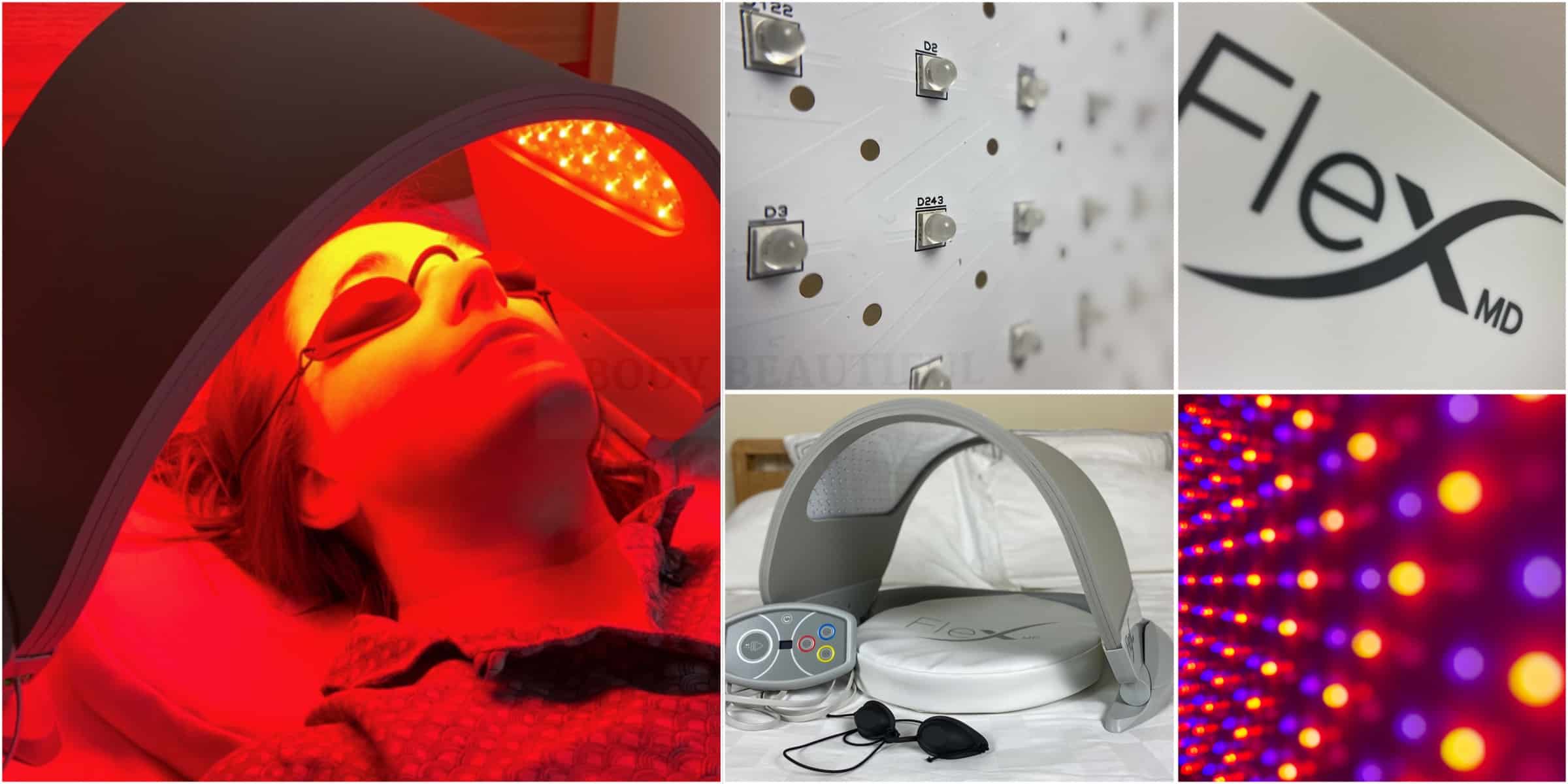 Dermalux Flex MD light therapy review: before vs after