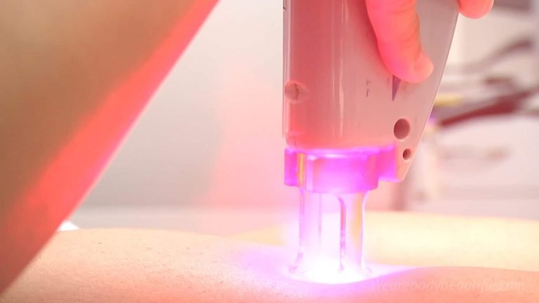 Close up photo of a laser treating the surface of skin