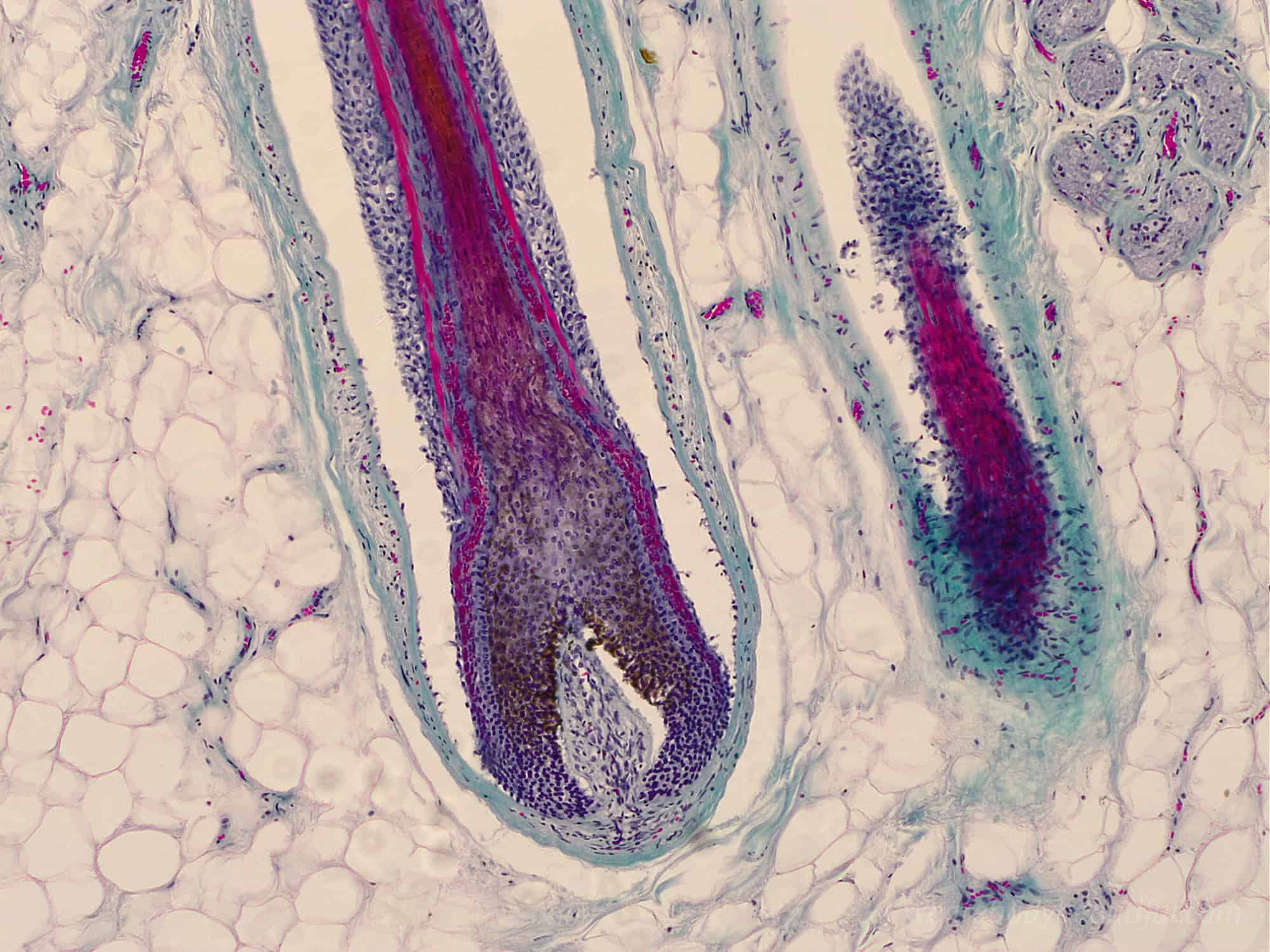 A close-up photo of a growing hair follicle in skin tissue. Learn what laser and IPL hair removal does to your follicles here.