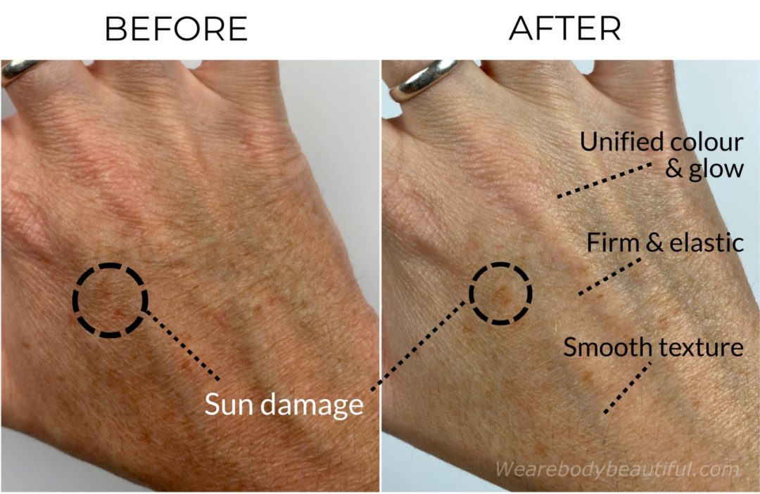 My LYMA laser before and after trial: Before and after comparison of my right hand. I see a unified colour & glow, firm & elastic skin, with a smoothed texture. The spots of sun damage are more noticeable now, but they don't bother me too much because the rest of my skin looks lush!