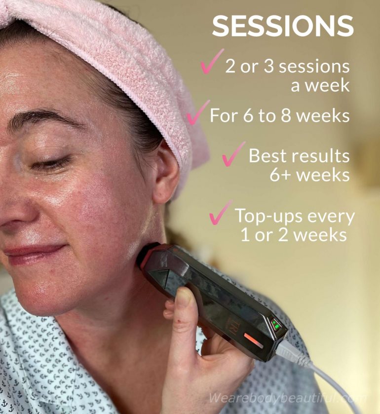 With the Tripollar STOP do 2 or 3 sessions per week, For 6 to 8 weeks, Best results after 6 weeks, Top-ups every 1 or 2 weeks