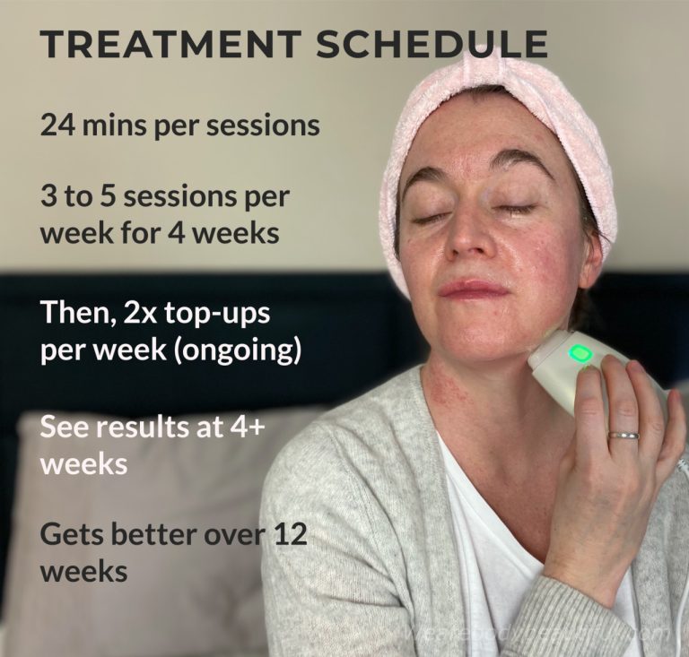 This is the NEWA treatment schedule; Do 3 to 5 sessions per week with the NEWA for 4 weeks. Then do 2 top-ups per week ongoing. You’ll see and feel results after 4 weeks with further improvements over 12 weeks total.
