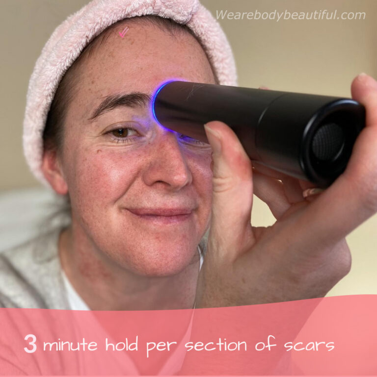 For scars and other trouble spots, hold the LYMA laser for 3 minutes on each section of skin.