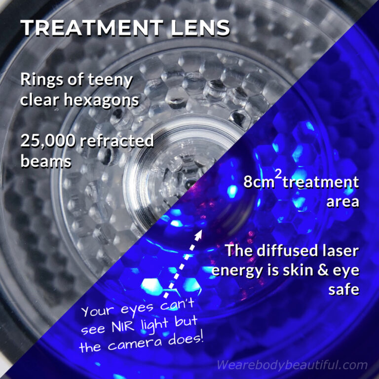 The LYMA Laser’s treatment lens is made of rings of tiny, clear hexagons which refract the laser 25,000 times around the 8cm2 lens. This makes the diffused laser energy skin and eye safe. Our eyes can’t see the NIR laser beam, but the camera picks it up in this photo.