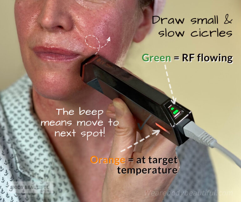 Draw small and slow circles over the treatment area. The green light means the RF is flowing, and the orange light means your skin is at the target temperature! The aim is to keep the green and orange light on for the full 4 to 5 mins per treatment area. Sometimes the device beeps to let you know to move to the adjacent bit of skin.