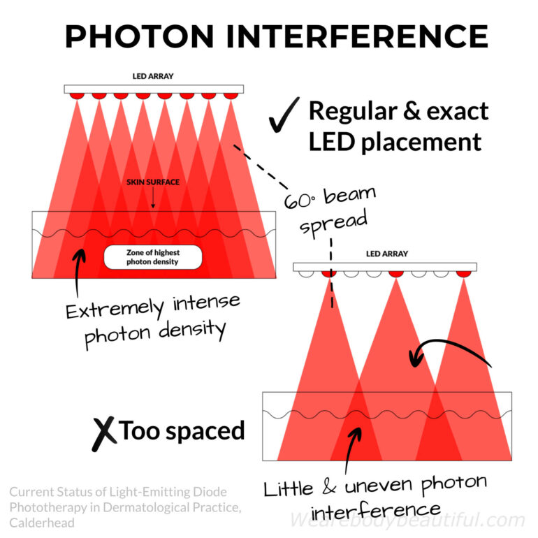 Diagrams from a scientific paper (Current Status of Light-Emitting Diode Phototherapy in Dermatological Practice, Calderhead). The first illustrates an array with regular and exact LED placement so the 60° beams crossover and create consistent, extremely intense photon intensity below the skin surface. The second of an array that is too spaced out, so there is just a little crossover with uneven photon interference below the skin.